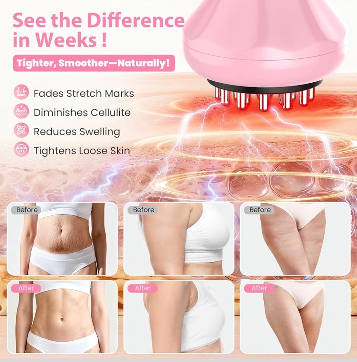 Body By Essence™ 4-in-1 Electric Lymphatic Body Massager – Pink Red Light Body Sculpting Tool for Massage, Circulation & Self-Care