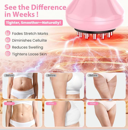 Body By Essence™ 4-in-1 Electric Lymphatic Body Massager – Pink Red Light Body Sculpting Tool for Massage, Circulation & Self-Care